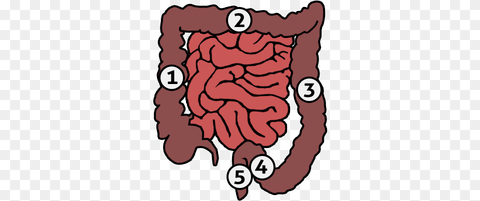 Human Colon Different Types Of Ostomies And Locations, Baby, Person, Body Part, Stomach Free Transparent Png