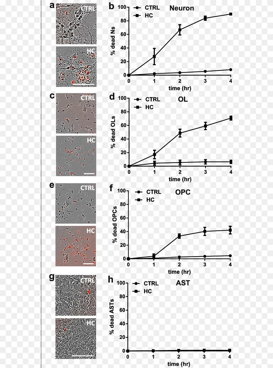 Human Complement Is Toxic To Mouse Neurons And Oligodendrocytes, Art, Collage Free Transparent Png