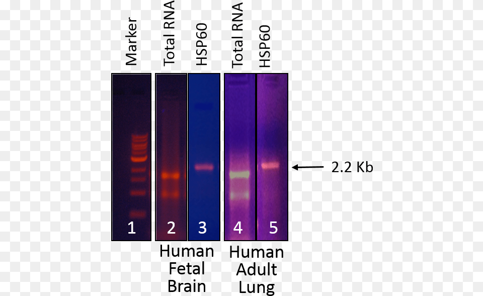 Human Fetal Brain And Human Adult Lung Lines 4 5 Colorfulness, Purple, Indoors Png