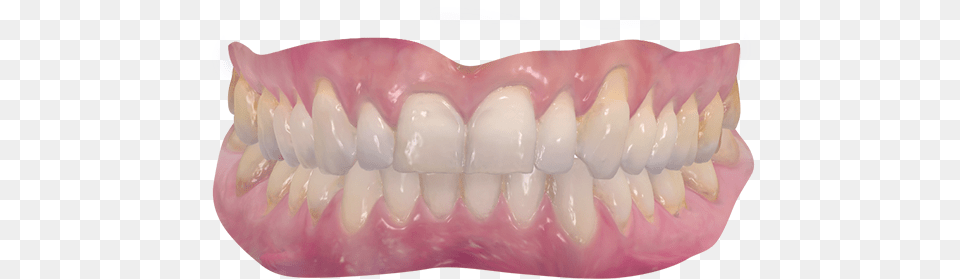 Human Mouth, Body Part, Person, Teeth, Head Free Transparent Png