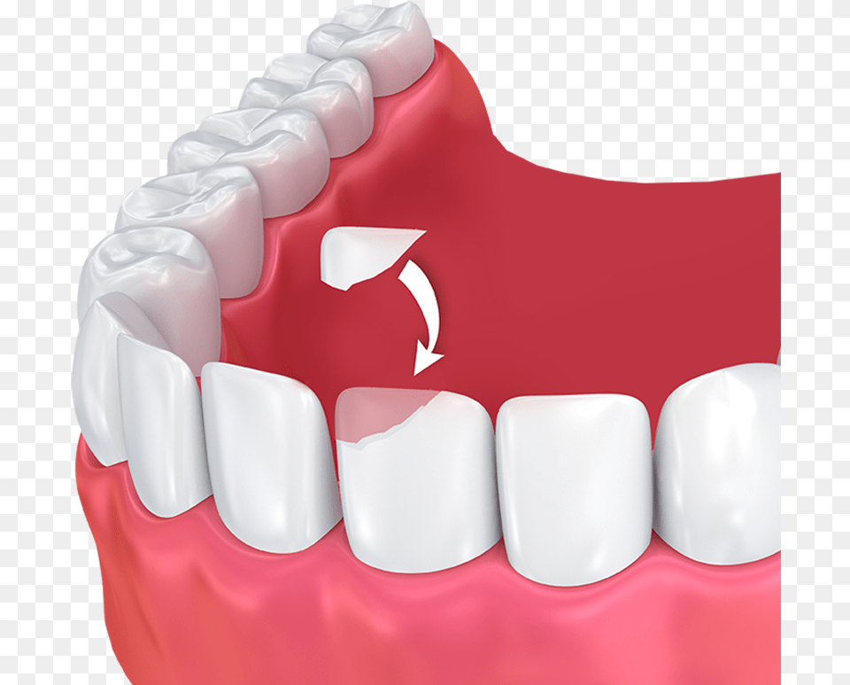 Human Tooth, Teeth, Body Part, Person, Mouth Png Image