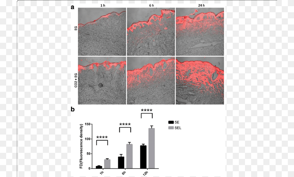 Hypertrophic Scar In Vitro Model, Mountain, Nature, Outdoors, Volcano Png Image