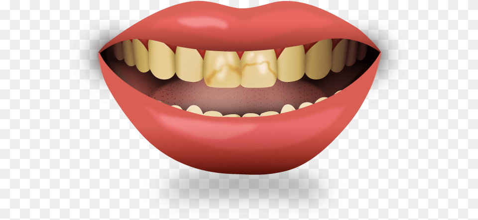 Illustration, Body Part, Mouth, Person, Teeth Png