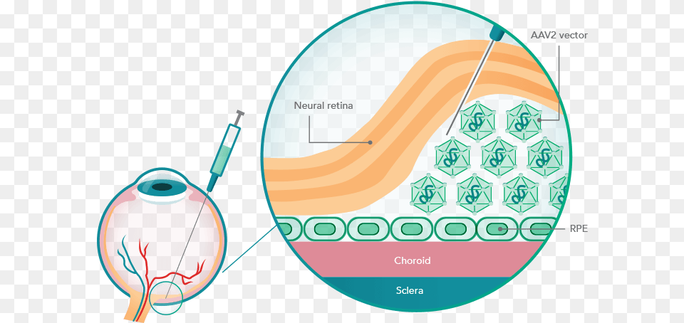 Illustration Of The Rpe65 Gene Delivery Method Luxturna Mechanism Of Action, Sphere, Disk Free Png Download