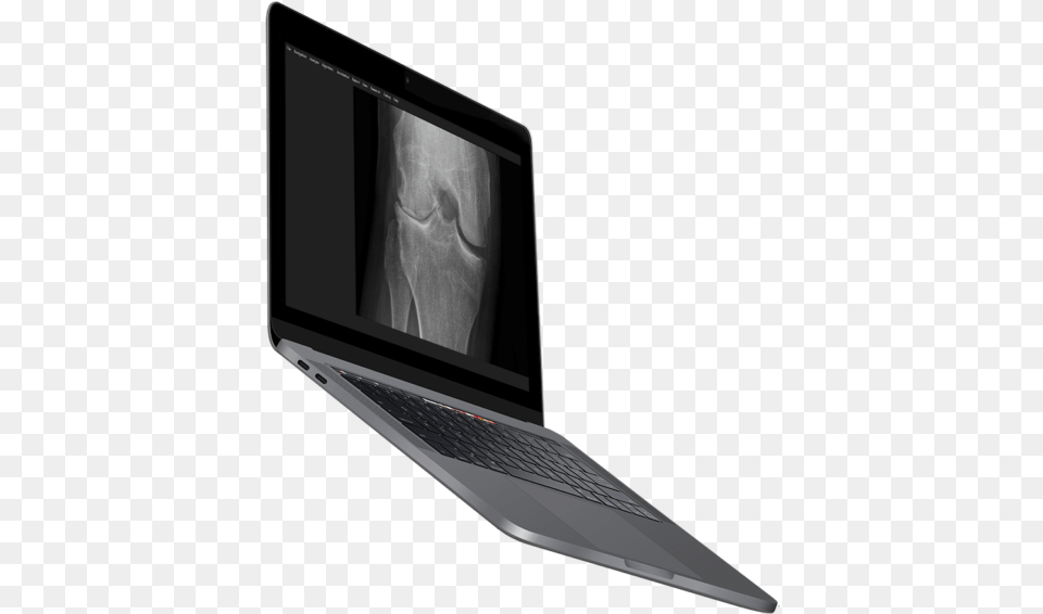 Image Biopsy Lab Software Laptop Output Device, Computer, Electronics, Pc, Computer Hardware Png