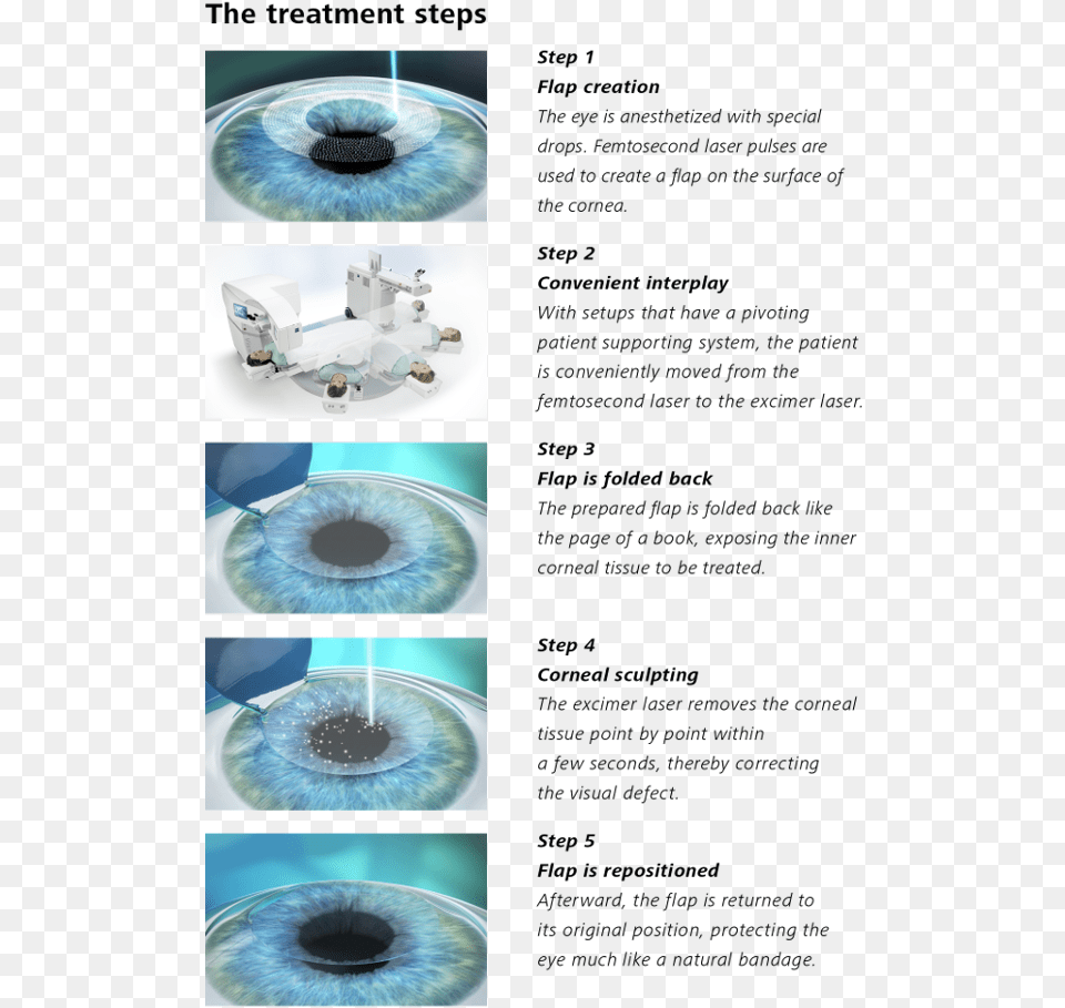 Image Lasik Procedure Steps, Water, Toy, Sink, Sink Faucet Free Png