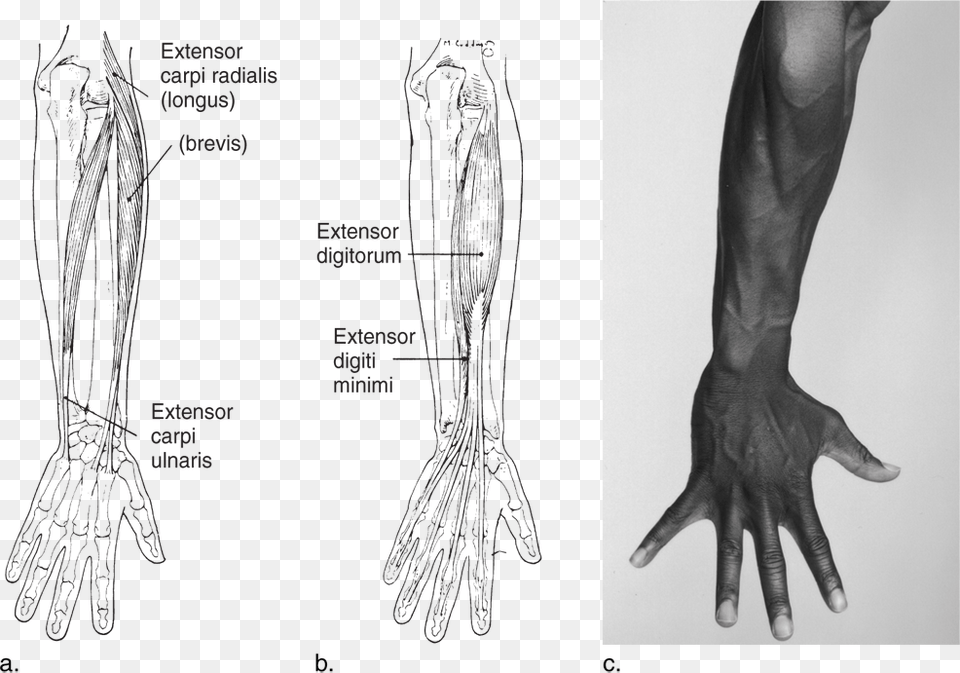 Image Not Available Medical Radiography, Body Part, Finger, Hand, Person Free Transparent Png