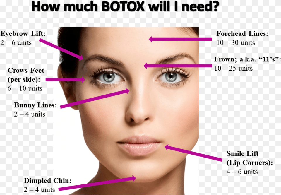 Image Result For Botox Injection Sites Chart Berricle Sterling Silver Round Cut Cz Halo Dangle Drop, Face, Head, Person, Adult Png