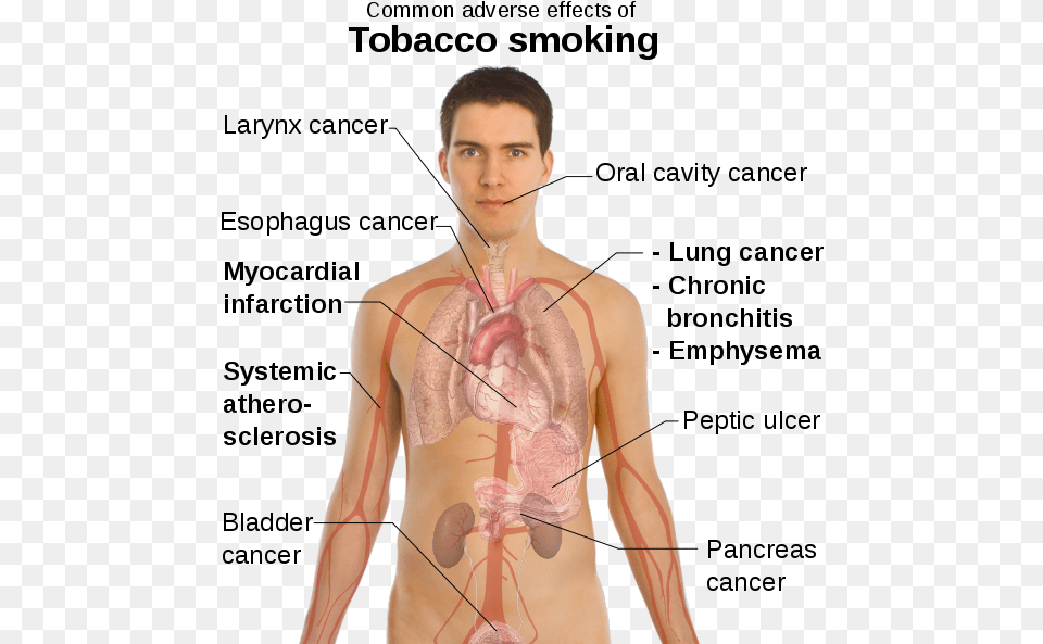 Img Diseases In Circulatory System Caused By Smoking, Adult, Male, Man, Person Png Image