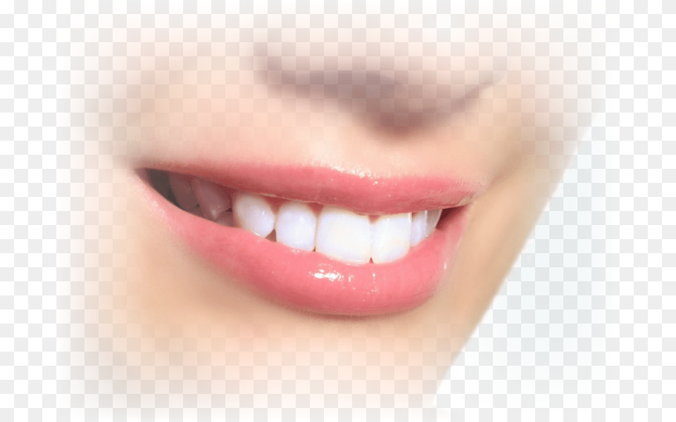 Img White Teeth, Body Part, Mouth, Person, Adult Png Image