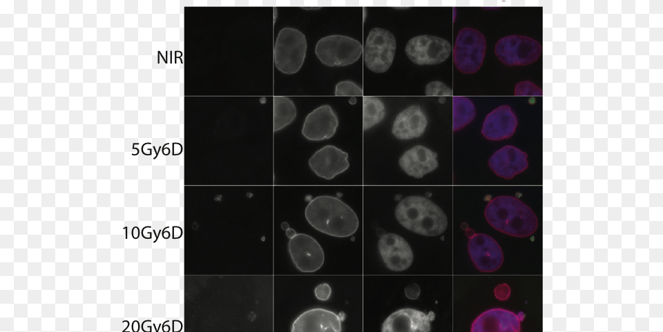 Immunofluorescent Staining Shows Co Staining Of Lamin Micronuclei Cgas Free Transparent Png