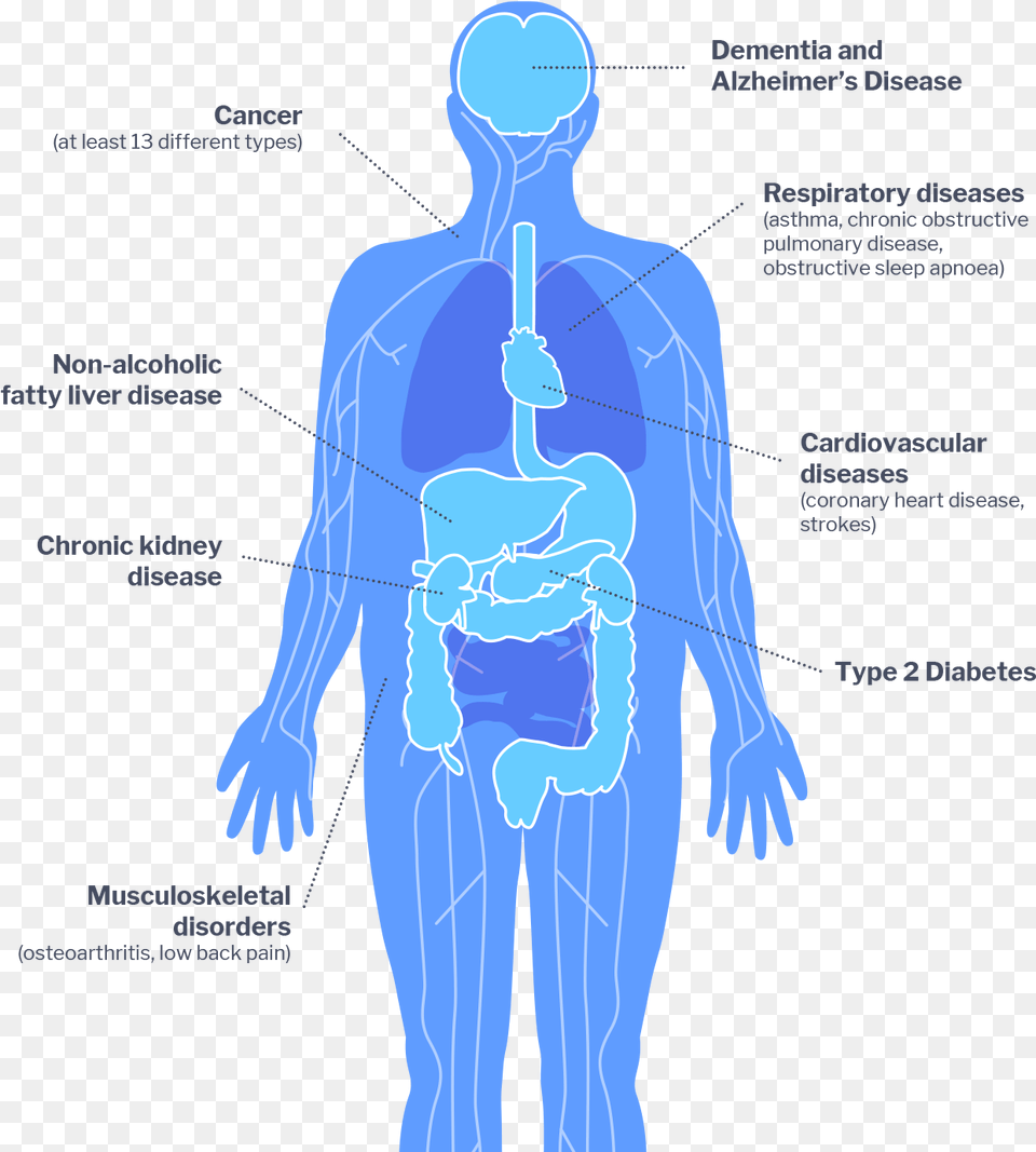 Impacts Of Diabetes On Health, Adult, Male, Man, Person Free Png Download