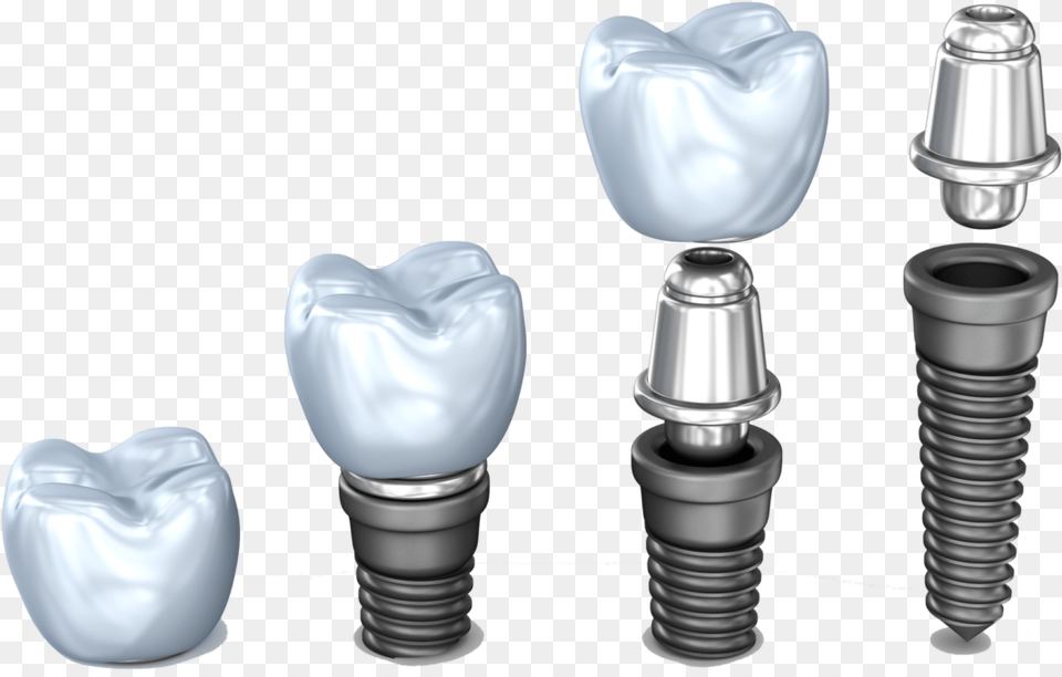Implant Pieces Dental Implant Dentist Northborough Implante Dental De Titanio, Light, Smoke Pipe, Lamp, Machine Free Png Download