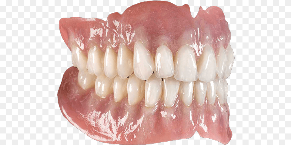 Implant Supported Dentures Los Angeles Dentures, Body Part, Mouth, Person, Teeth Free Transparent Png