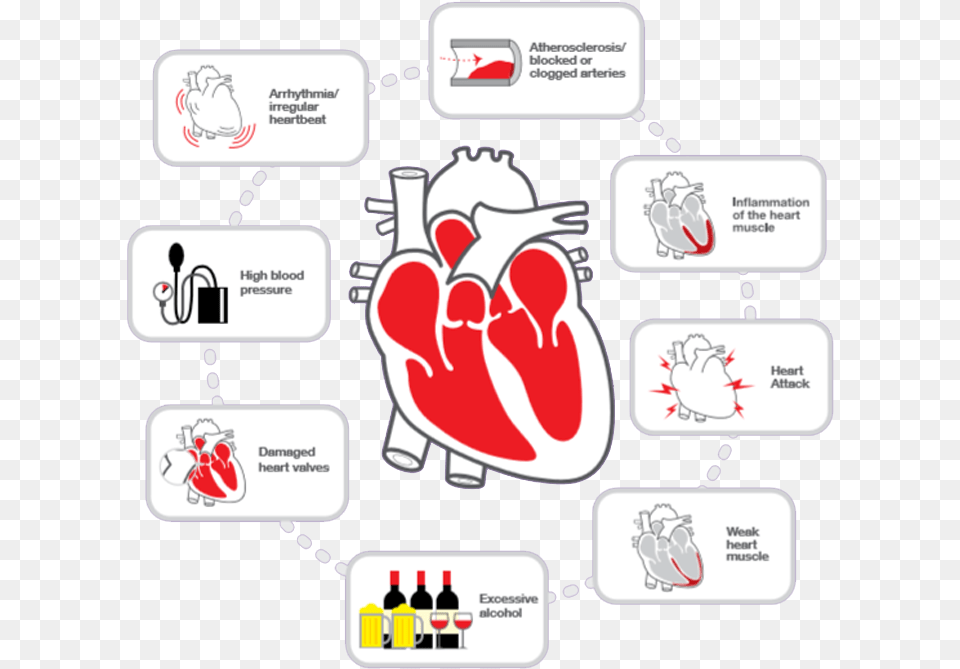 In Most Cases Heart Failure Does Not Have A Single Parallel, Book, Comics, Publication, Baby Free Transparent Png