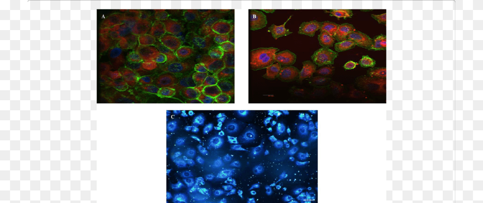 In Vitro Imaging Of The Ns Confocal Fluorescence Microscopy, Accessories, Ornament, Art, Collage Png