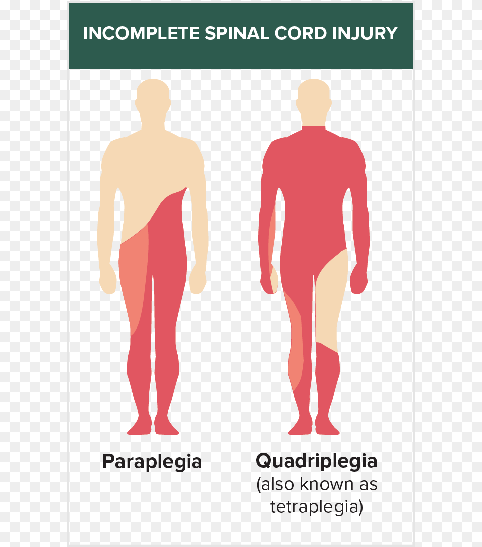 Incomplete Spinal Injury Incomplete Spinal Cord Injuries, Chart, Plot, Adult, Male Free Transparent Png