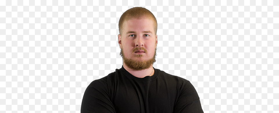 Incon Hair Loss, Adult, Beard, Face, Head Free Transparent Png