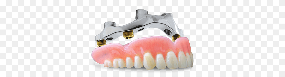 Index Of Overdenture, Body Part, Mouth, Person, Teeth Free Png