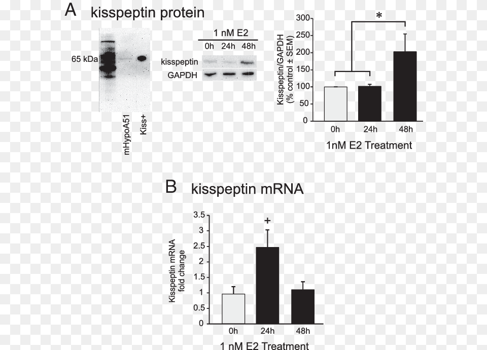 Induces Kisspeptin In Mhypoa51 Neurons Kisspeptin, Chart, Plot Free Transparent Png