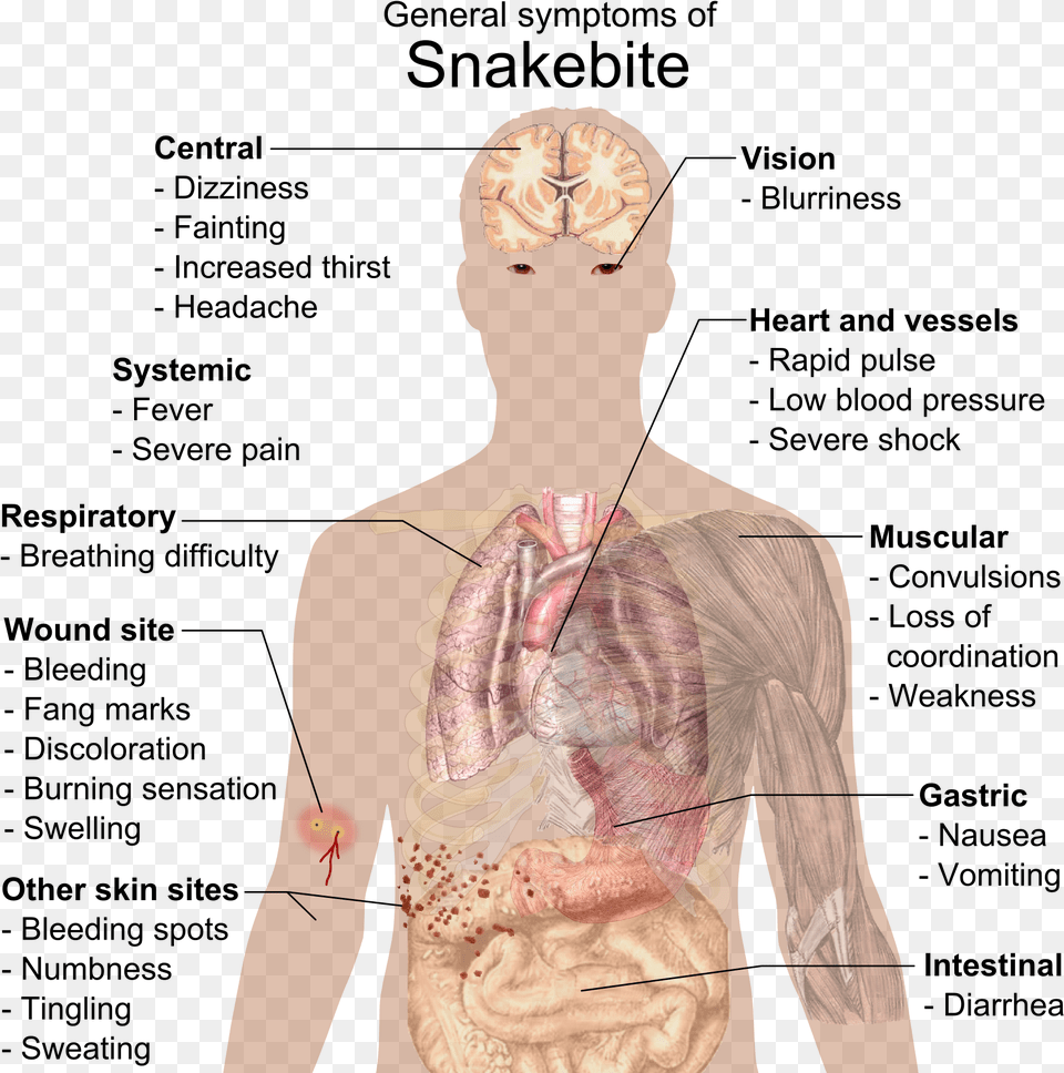 Infectious Mononucleosis, Person Png