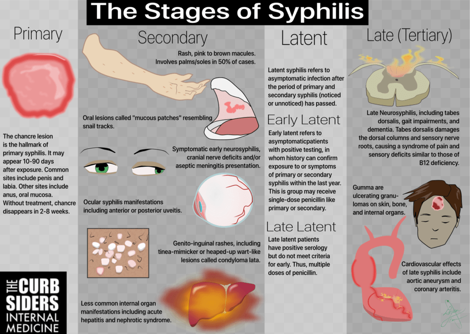 Infographic The Curbsiders 127 Stis Stages Of Syphilis Syphilis Stages, Advertisement, Poster, Person, Head Free Png Download