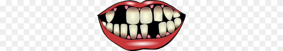 Information Brochures Archives, Body Part, Mouth, Person, Teeth Png