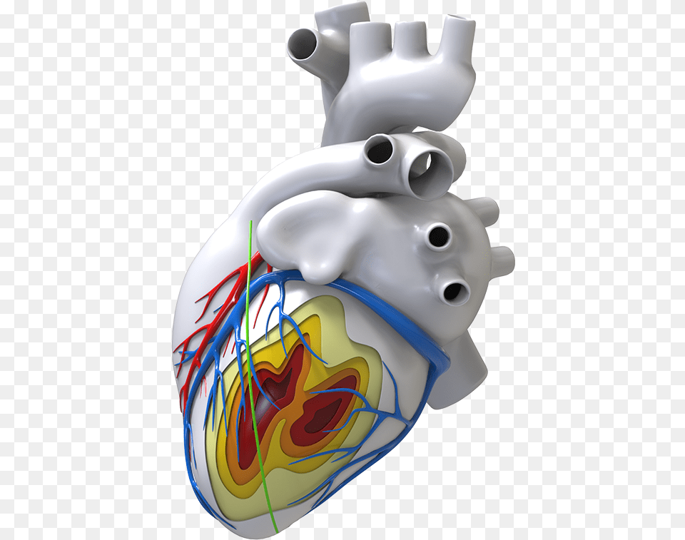 Inheart Where Imaging Meets Cardiac Electrophysiology Illustration, Smoke Pipe, Pottery Free Transparent Png