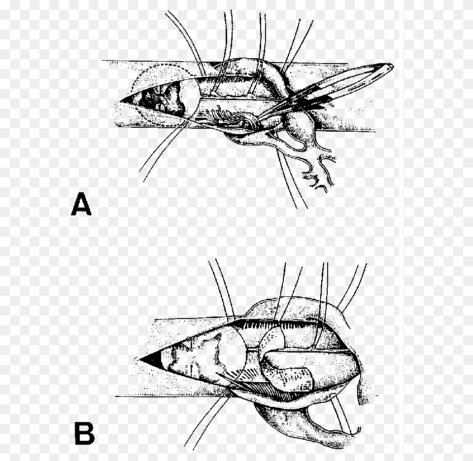 Insect, Gray Free Png Download