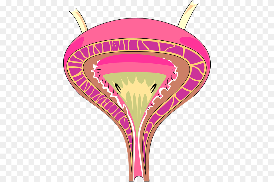 Interstitial Cystitis Clipart, Racket Png