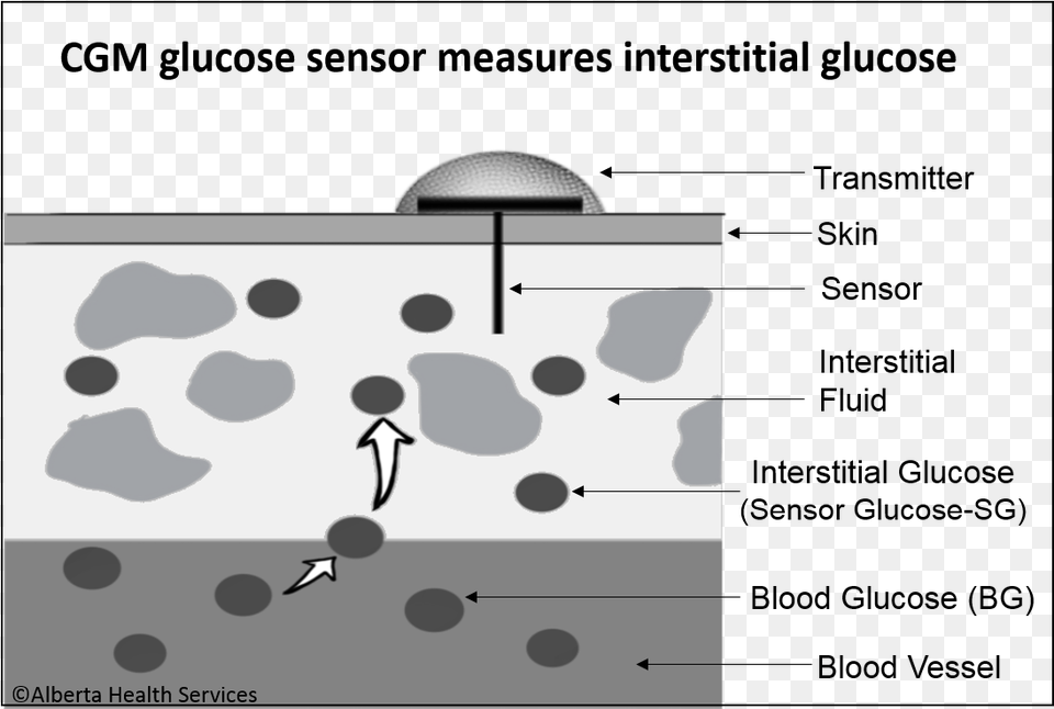 Interstitial Glucose Cgm 4ahs Continuous Glucose Monitoring Works, Person, Head Png