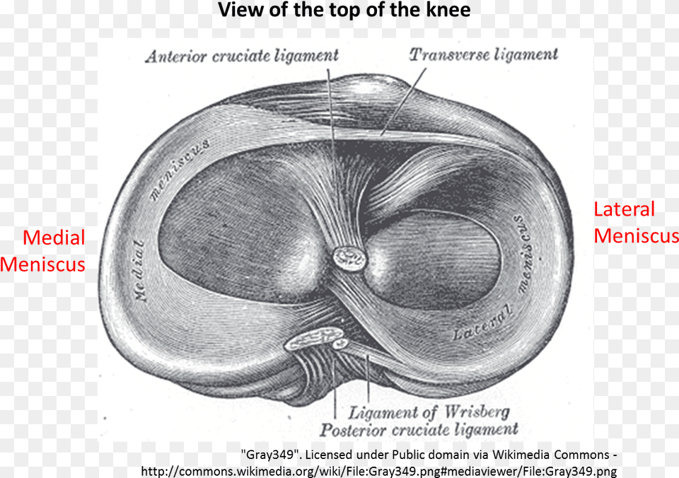 Intra Articular Extra Articular Ligament, Helmet Png