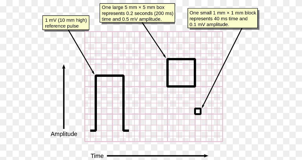 Introduction To Ecg Wikidoc Ecg Size, Game Png Image