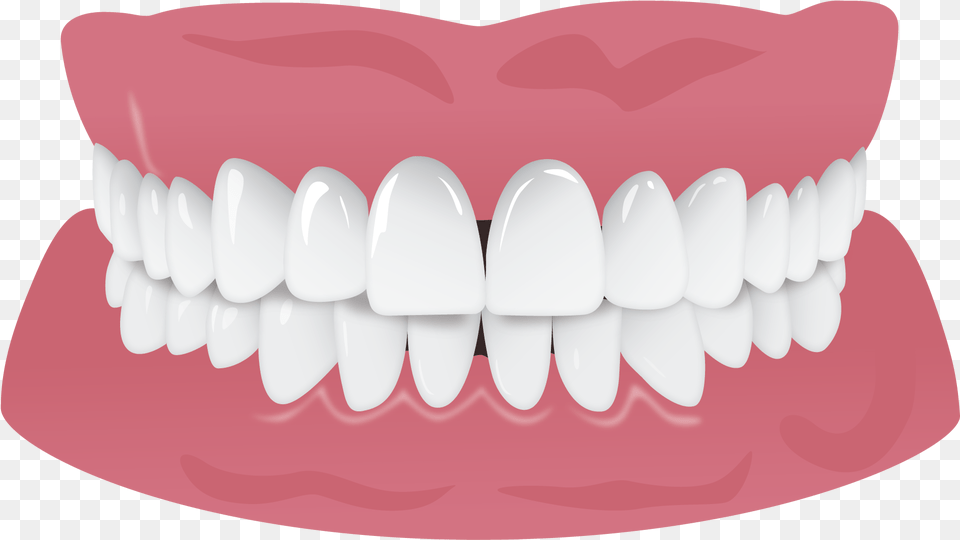 Invisalign Gap Teeth Missing Tooth, Body Part, Mouth, Person Free Png Download