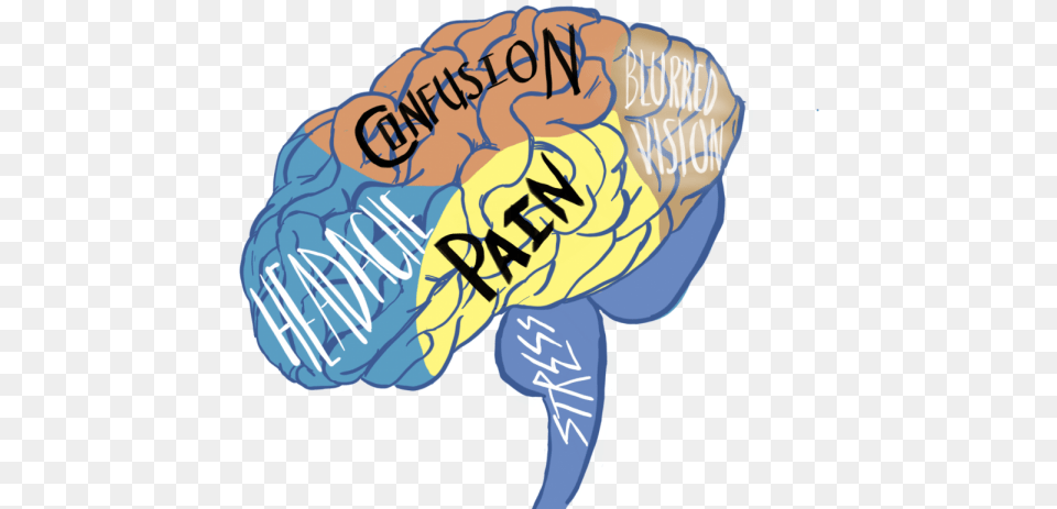 Issues Concussions The Kirkwood Concussion Art, Person Free Transparent Png