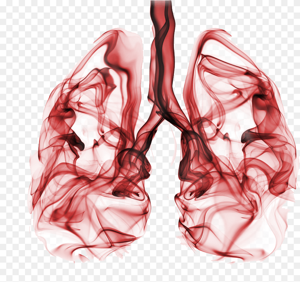 It Is Estimated That Around 80 Of All Lung Cancer Lung Cancer, Smoke, Ct Scan, Adult, Female Png