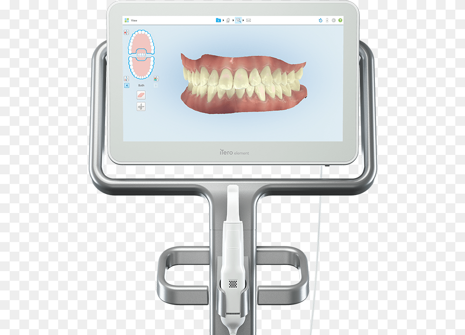 Itero Element 2 Impression Scanner Itero Element 2 Scanner, Body Part, Person, Mouth, Teeth Free Transparent Png