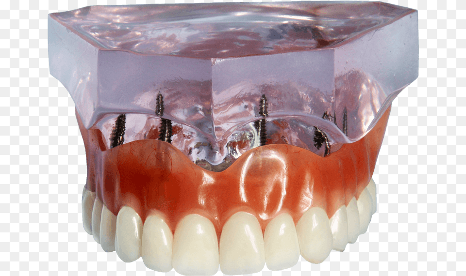 Jaw, Body Part, Mouth, Person, Teeth Free Png Download