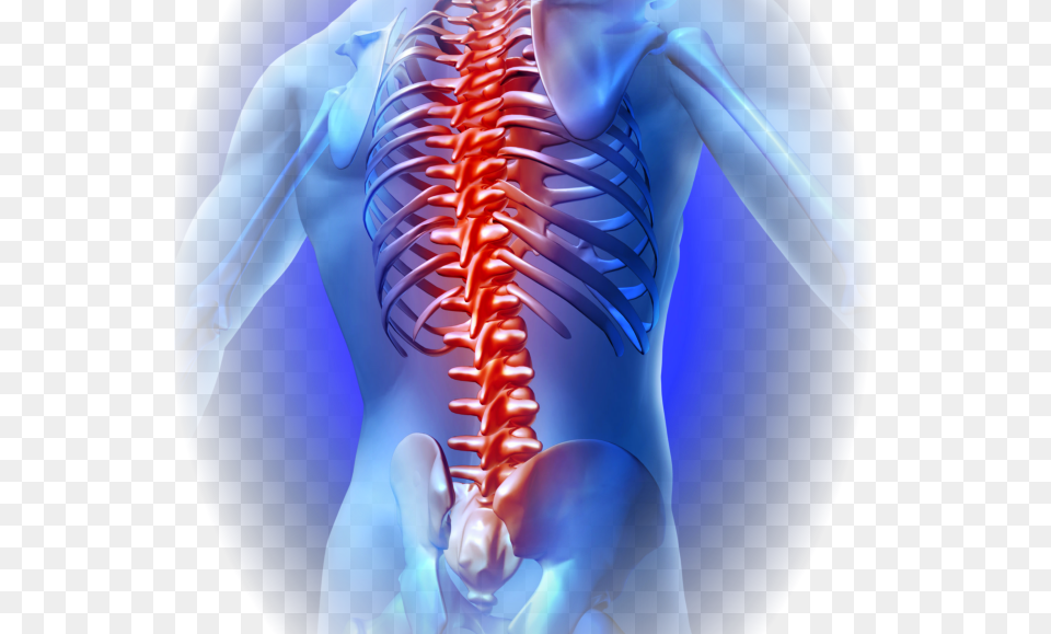 Joint Pain Back Bone Pain, Animal, Food, Invertebrate, Lobster Png Image
