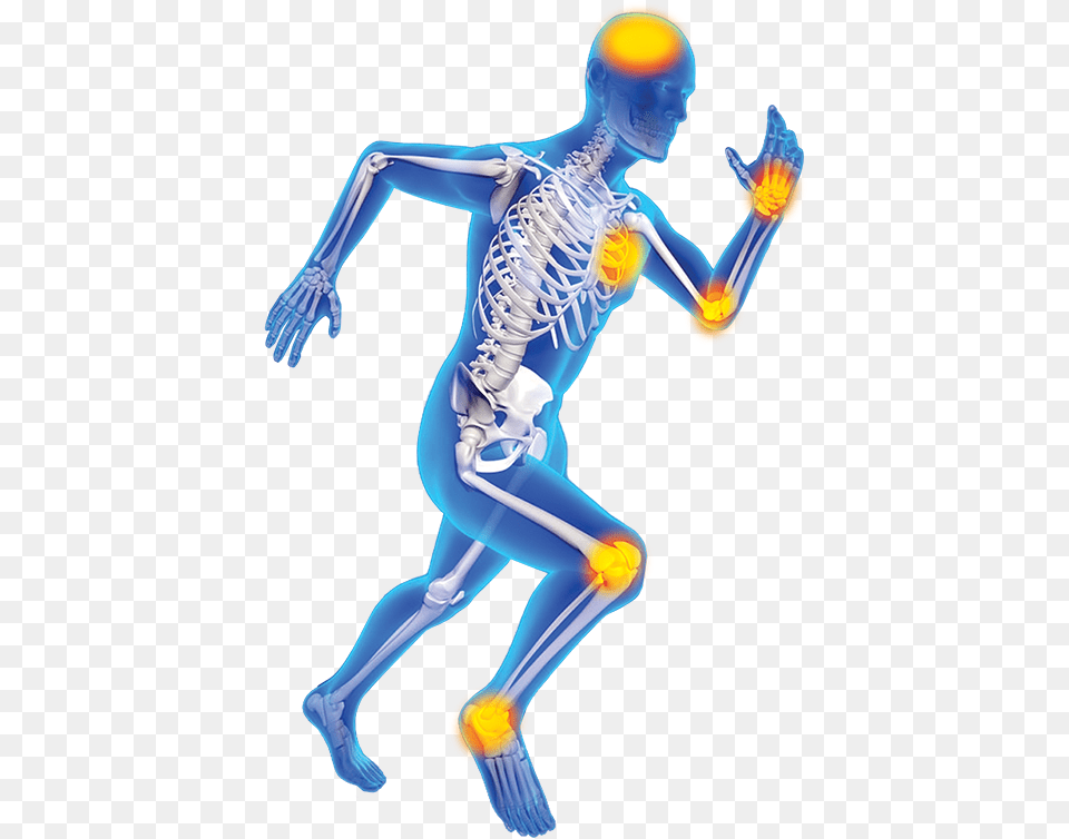 Joint Pain Skeleton Skeleton Pain, Adult, Female, Person, Woman Png