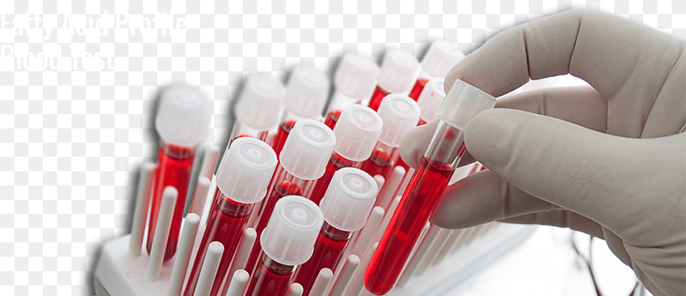 Keep Fat Related Health Problems In Check Blood Test Tubes, Cosmetics, Lipstick Free Png Download