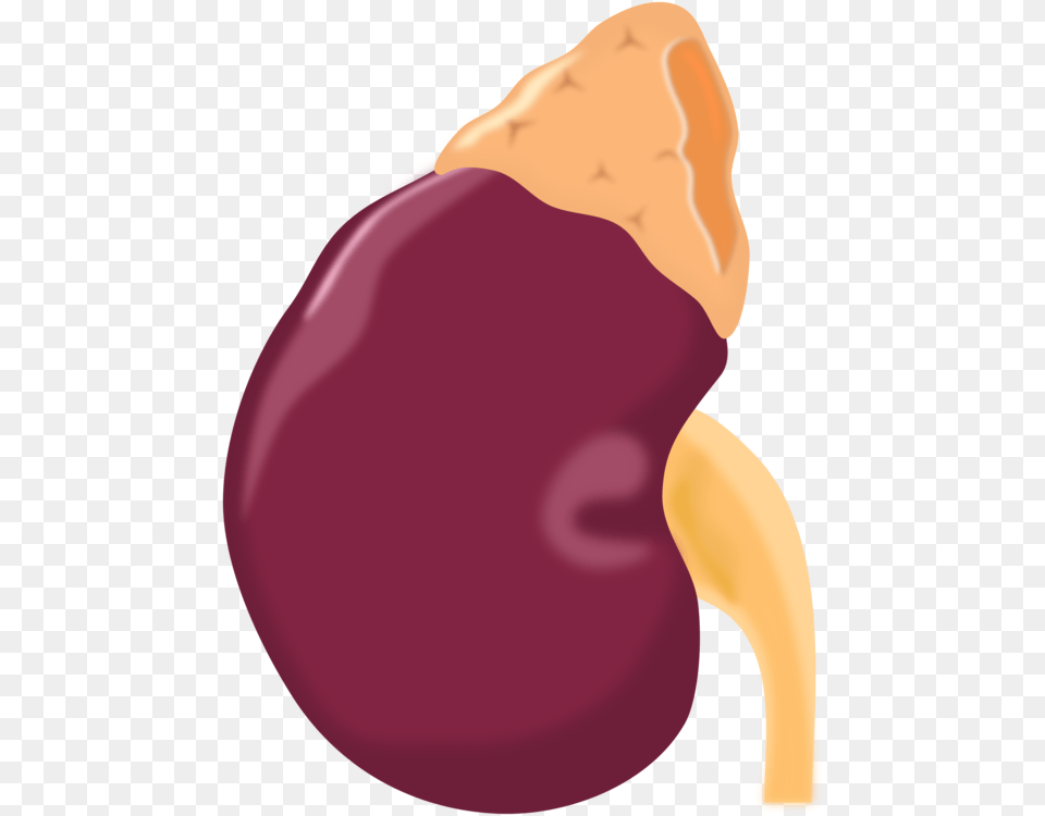 Kidney Stone Human Body Organ Kidney Bean, Food, Produce, Adult, Female Png
