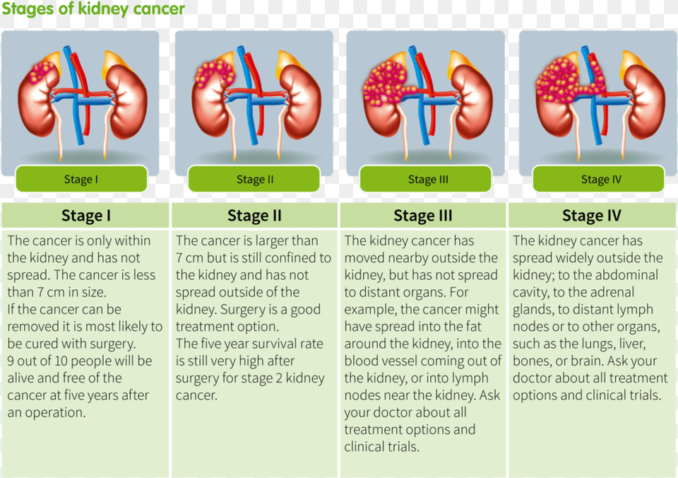 Kidney Tumor Stages, Text Png Image