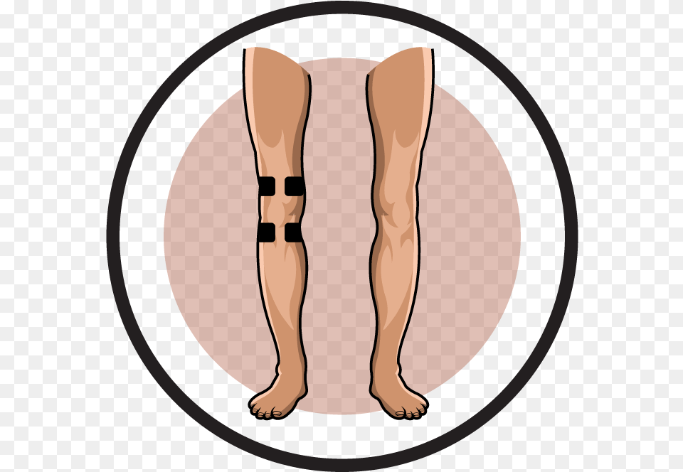 Knee Clipart Injured Knee, Ankle, Body Part, Person, Skin Free Png