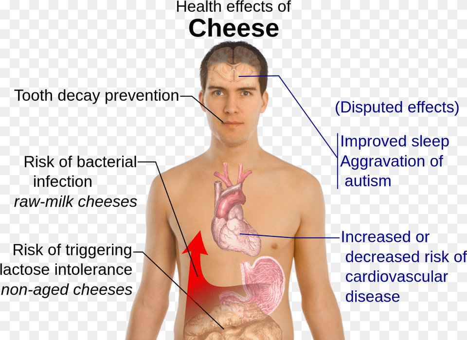 Lactose Intolerance Effects, Adult, Female, Person, Woman Png Image