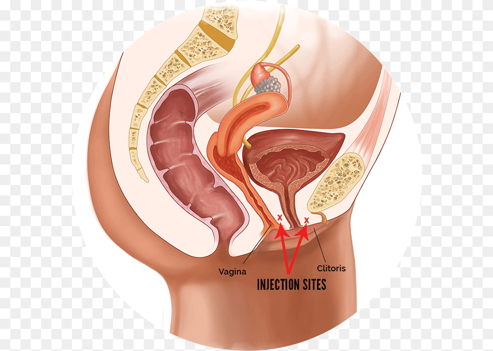 Lady Spot Shot Diagrahm Female Reproductive System No Labels, Body Part, Stomach, Face, Head Free Png