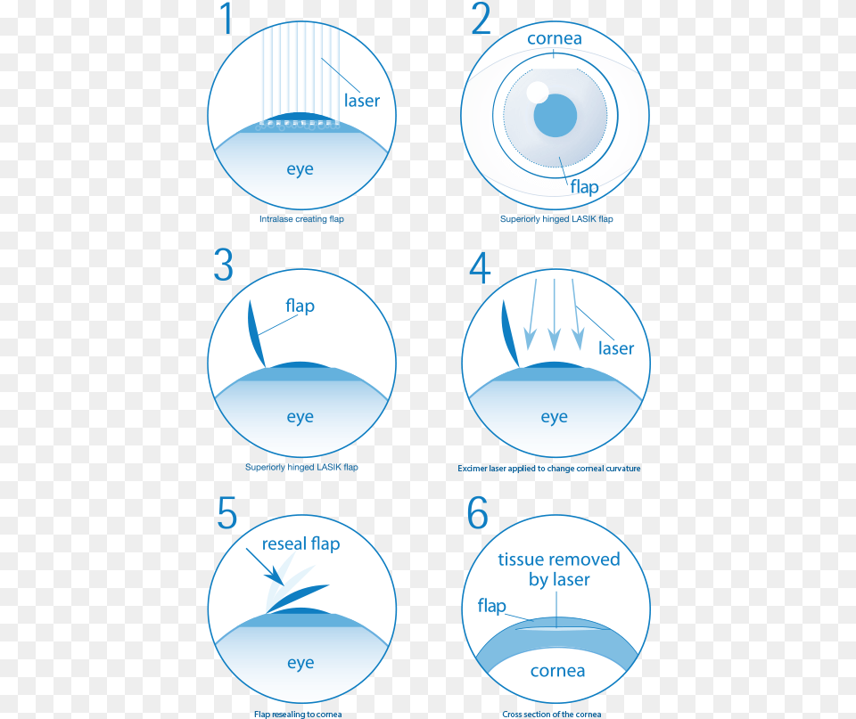 Lasik Circle, Sphere, Disk Png Image