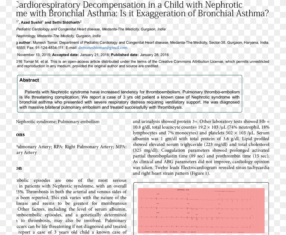 Lead Ecg Showing Sinus Tachycardia Deep 39s39 Wave Electrocardiography, Page, Text, Chart, Plot Free Transparent Png