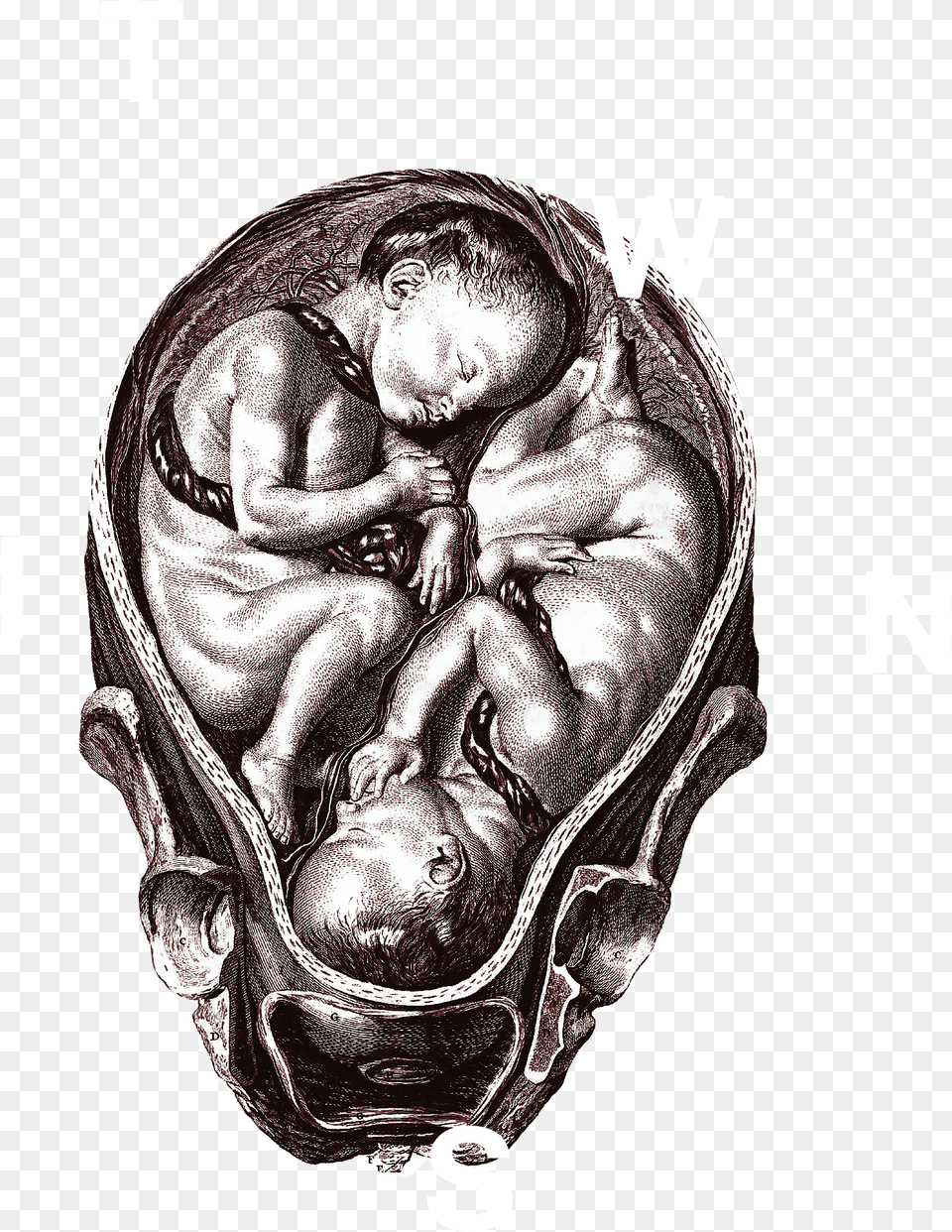 Library Anatomical Drawing Medieval Munro Kerr39s Operative Obstetrics Book, Baby, Person, Accessories, Face Free Png Download