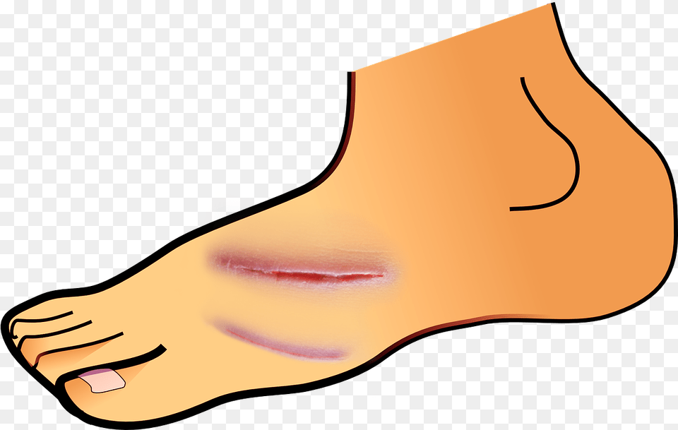 Library Of Foot Cut Jpg Freeuse Stock Foot Clipart, Adult, Ankle, Body Part, Female Png